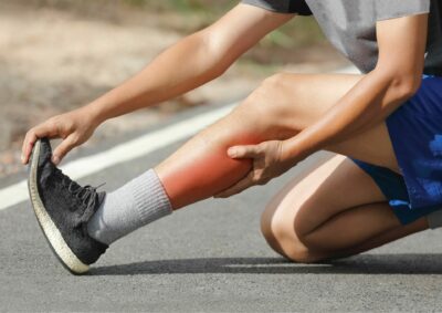 Exercise Associated Muscle Cramps: Part 1